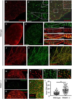 Pannexin 1 Modulates Axonal Growth in Mouse Peripheral Nerves